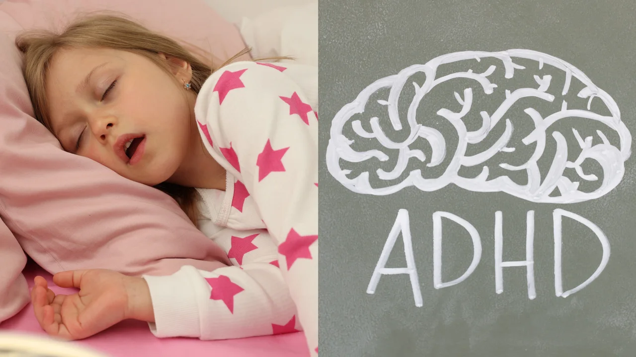 Illustration: Nasal Block from Enlarged Adenoids and Its Link to ADHD in Children